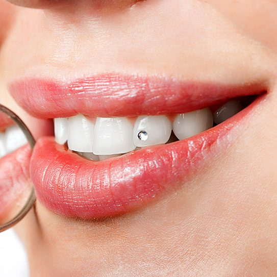smile jewelry dentist near me