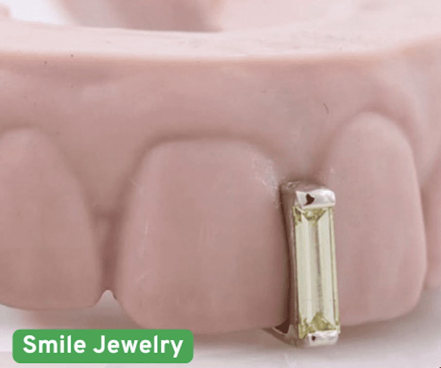 smile jewelry dentist near me