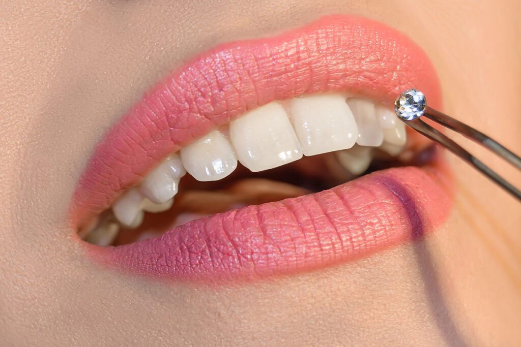smile jewelry Orlando dentist