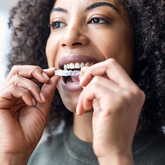 Invisalign Orlando Invisalign near me