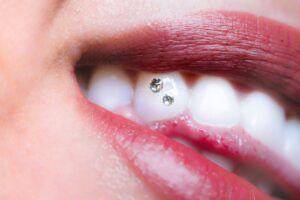 Orlando dentist