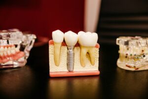 Orlando dentist