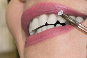 tooth gems