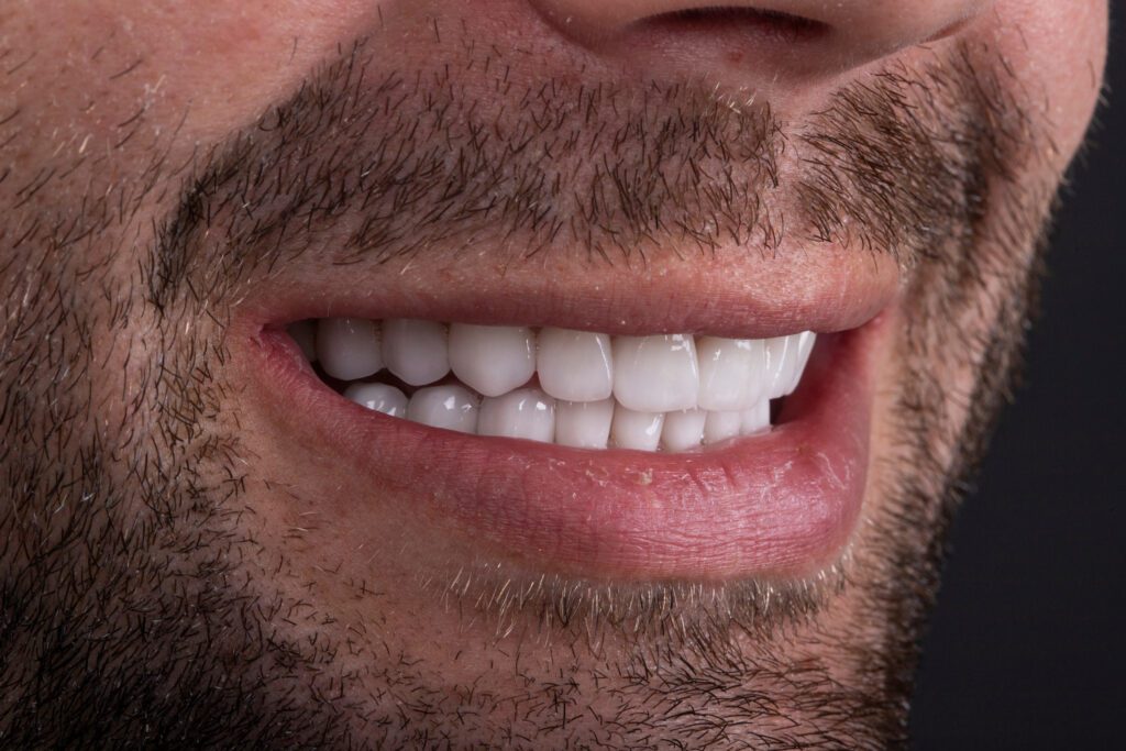 teeth whitening orlando